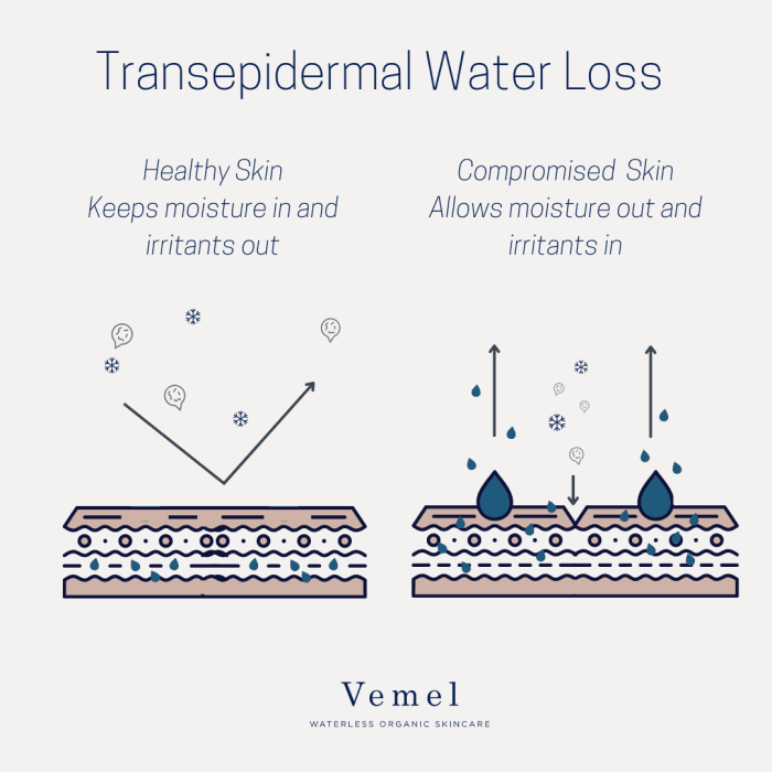 How can transepidermal water loss be prevented